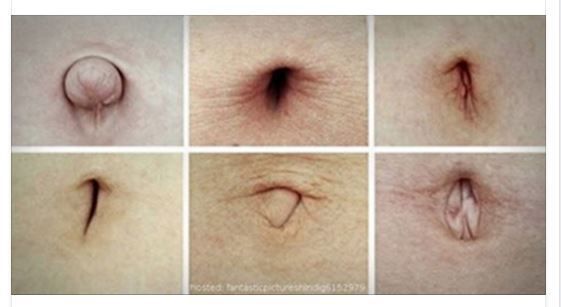 La forma del tuo ombelico rivela tantissime cose. Ecco di cosa si tratta